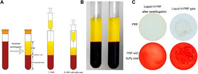 Liquid platelet-rich fibrin produced via horizontal centrifugation decreases the inflammatory response and promotes chondrocyte regeneration in vitro